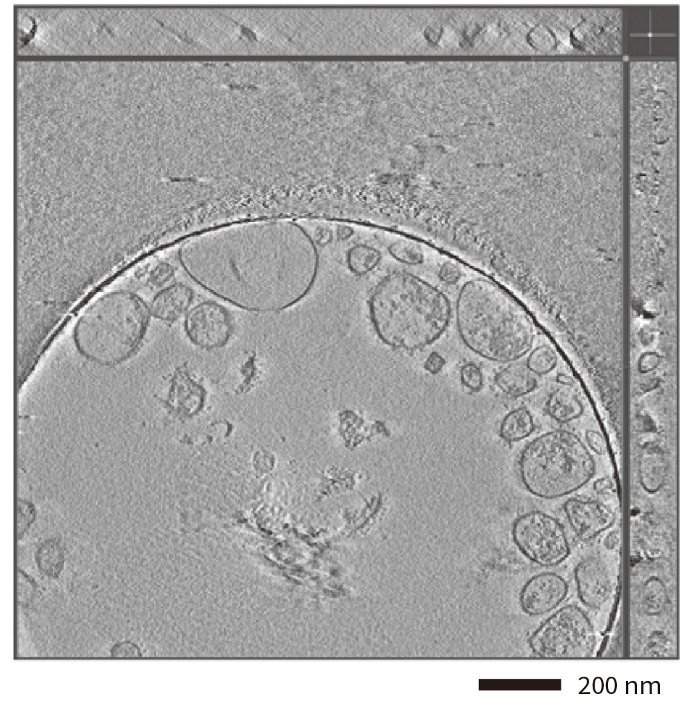 Cryo-electron tomogram of isolated exosomes with a hole-free phase plate.