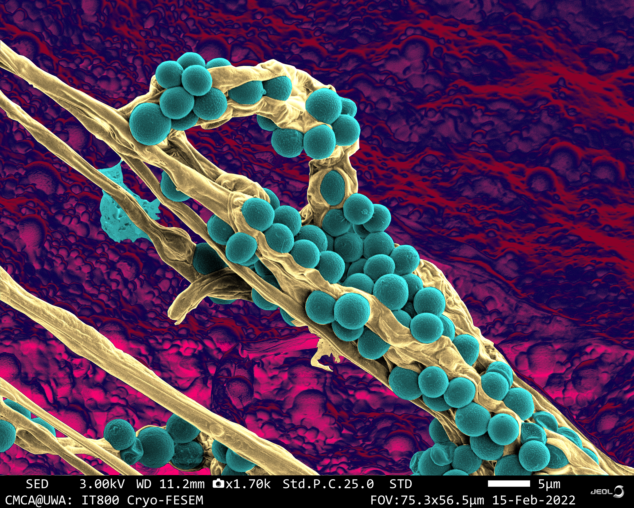 SUBJECT: Surface image of blue cheese highlighting the penicillium spp typical of these cheeses; CREDIT: Dr Jeremy Shaw and Dr Crystal Cooper, The University of Western Australia; METHOD/INSTRUMENT: JEOL IT800 Cryo-FESEM / Leica VCT500 cryo-system