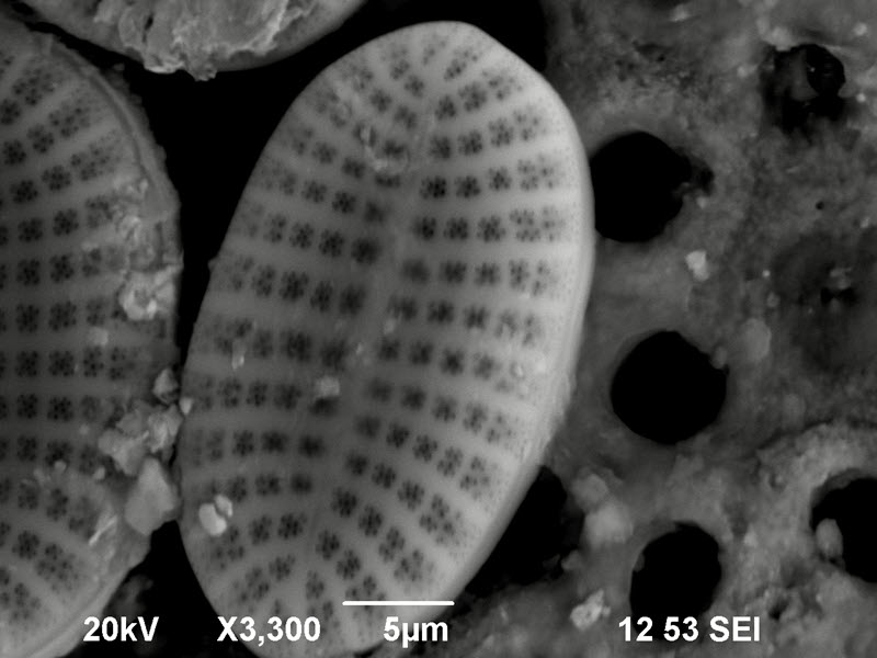 SUBJECT: Diatom of genus Cocconeis; CREDIT: Jose L  Hernandez Jr., San Joaquin Delta College; METHOD/INSTRUMENT: JEOL 6400 SEM