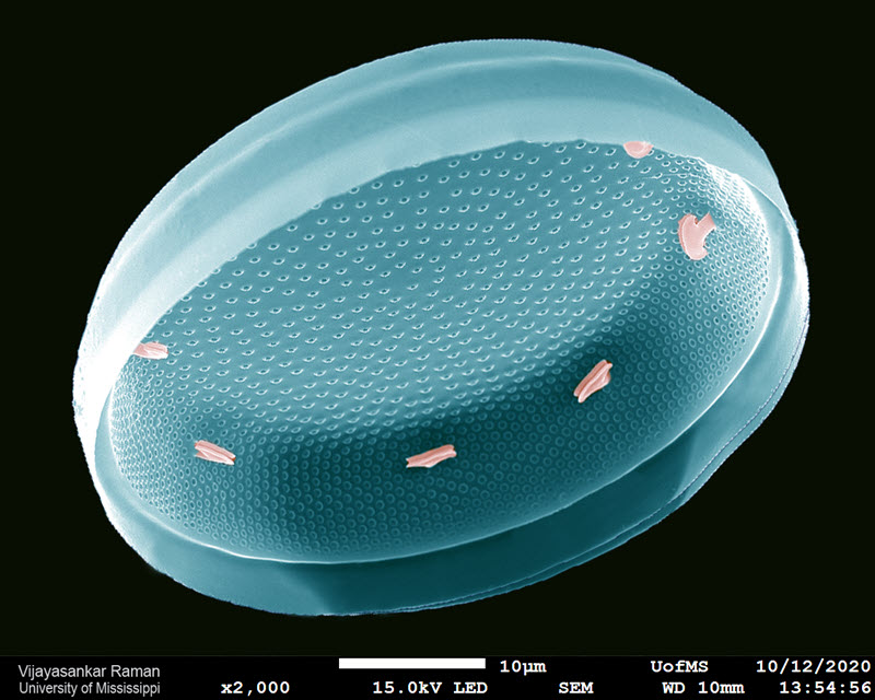 TITLE: UFO - Unidentified Floating Object!; SUBJECT: Colorized SEM image of a centric diatom; CREDIT: Vijayasankar Raman, The University of Mississippi; METHOD/INSTRUMENT: JEOL JSM-7200FLV