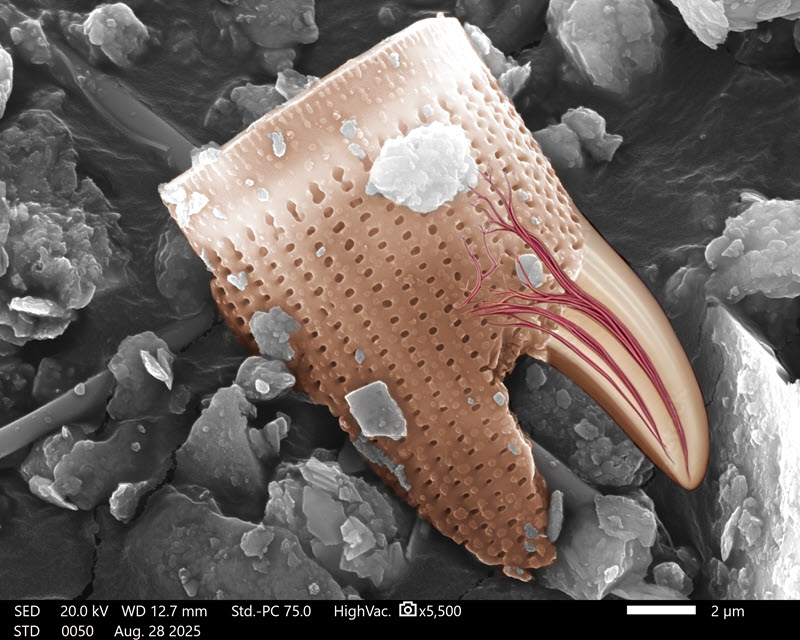 TITLE: Wisdom tooth; CREDIT: Maryam Karami; METHOD/INSTRUMENT: JEOL IT-500HR