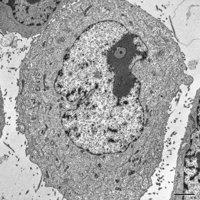 TITLE: Eagle eye; SUBJECT: Nucleus of a cell resembling an eye of an eagle; CREDIT: Siddhi Redkar, ACTREC-TMC, Kharghar, Navi Mumbai, India; METHOD/INSTRUMENT: JEOL JEM 1400PLUS