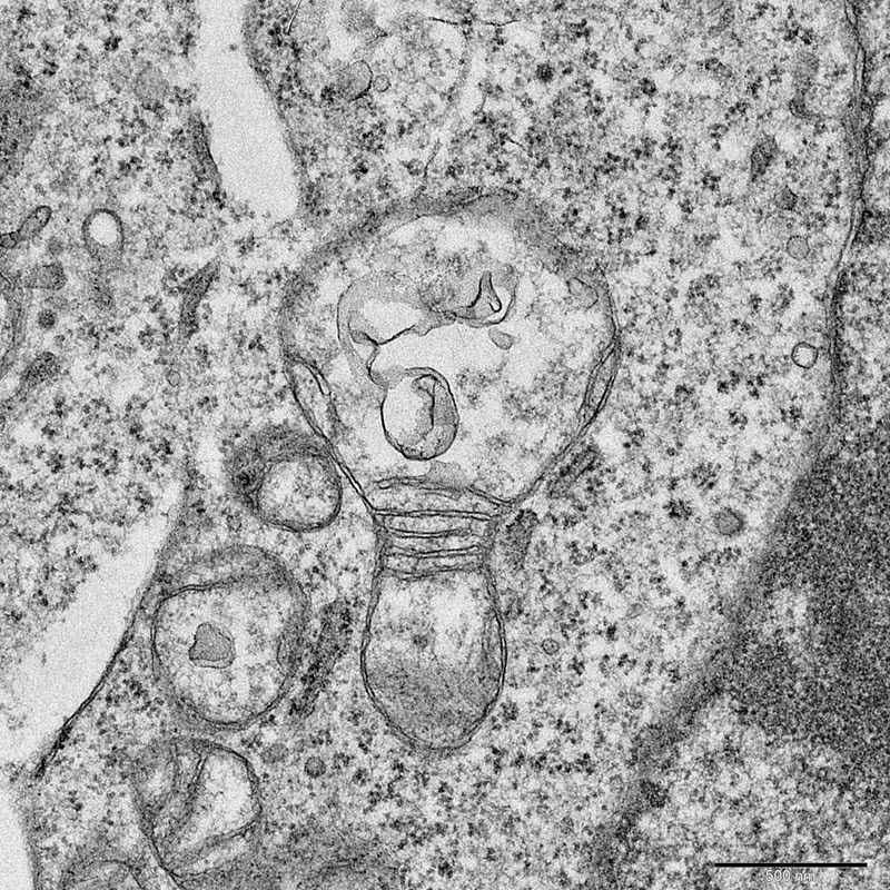 TITLE: Idea !!!; SUBJECT: Idea - A swollen mitochondria resembling a lightened bulb.; CREDIT: Siddhi Redkar, ACTREC, Tata Memorial Centre, Kharghar, Navi Mumbai; METHOD/INSTRUMENT: JEOL JEM 1400 PLUS