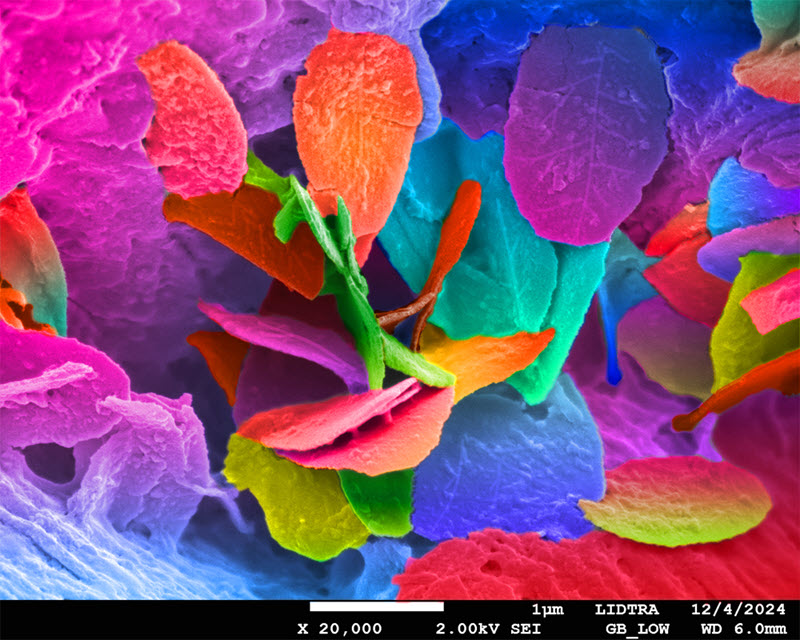 TITLE: Confetti of Crystals at the Micro Scale; SUBJECT: A kidney stone composed mainly of calcium and oxygen crystals, whose structures are arranged in patterns that evoke a vibrant mosaic at the microscopic scale.; CREDIT: Liliana Naranjo Naranjo y Juana Yesenia Ramos Martínez Colaboration, LIDTRA, CINVESTAV-Querétaro; METHOD/INSTRUMENT: JSM-7610F