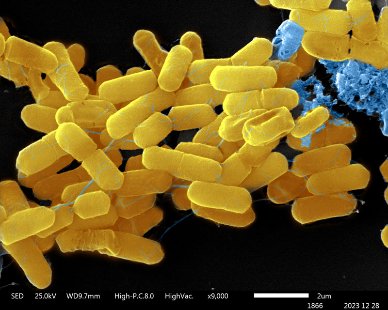 TITLE: Pseudomona aeruginosa; SUBJECT: Pseudomona aeruginosa; CREDIT: Rocio Orellana Fernandez, Universidad de Chile; METHOD/INSTRUMENT: Jeol JSM-IT 300 LV