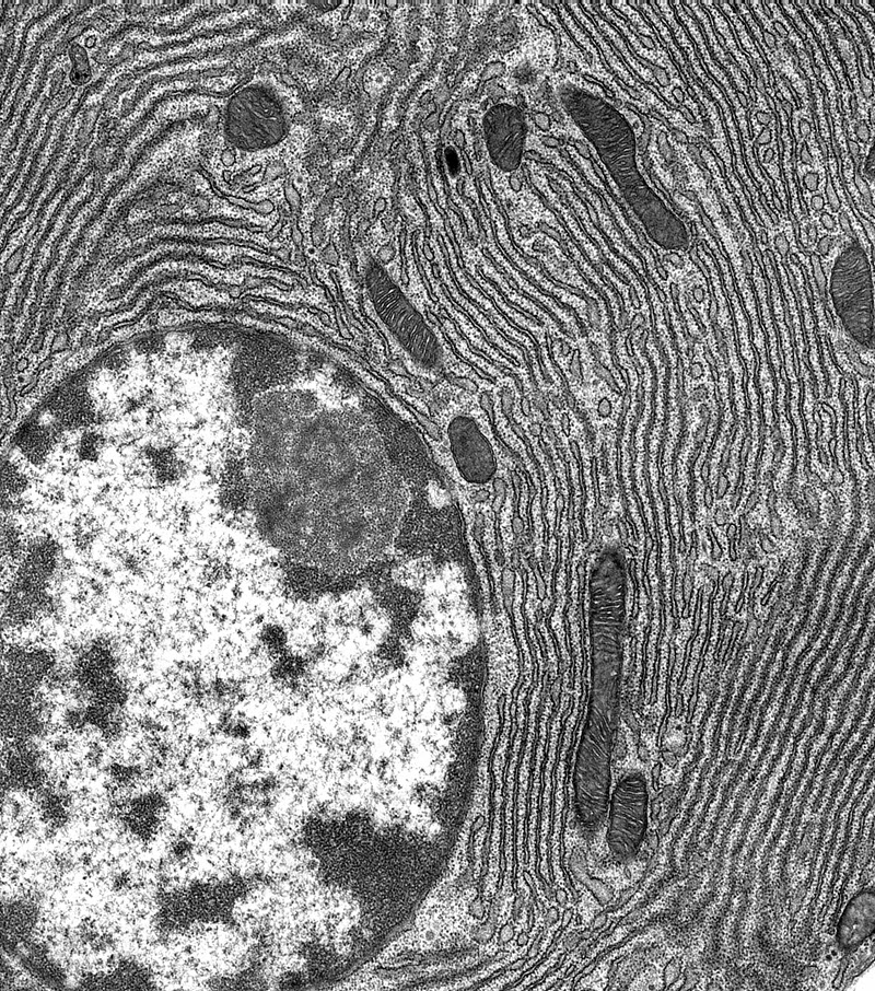 SUBJECT: Acinar Cell of the Pancreas - An Enzyme Factory TEM image of waves of RER (rough endoplasmic reticulum) crashing ashore on a nucleus in an Exocrine Acinar Cell of the pancreas; CREDIT: Patrick Nahirney, University of Victoria; METHOD/INSTRUMENT: JEOL JEM1400