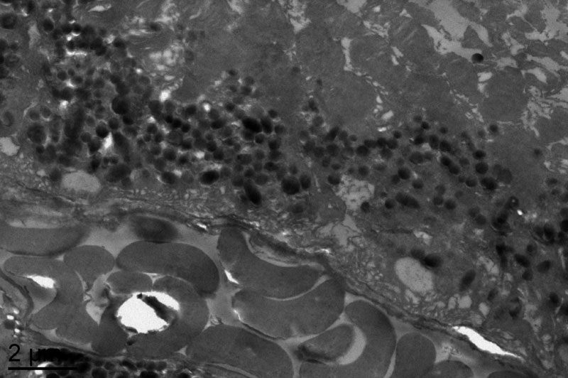 Subject: TEM Image of Dark Adapted Mouse Retinal Pigment Epithelium; Credit: Tiffany Stone, Texas State University; Instrument: TEM- JEM 1200 EX II