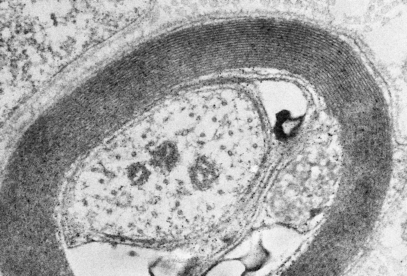 TITLE: This Bird is Getting on My Nerves; SUBJECT: sciatic nerve axon; CREDIT: Lita Duraine, Baylor College of Medicine; METHOD/INSTRUMENT: JEOL 1400+ TEM