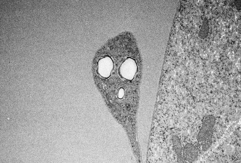 TITLE: The Screamer 2020; SUBJECT: Image of Drosophila melanogaster firing between boutons; CREDIT: Lita Duraine, Baylor College of Medicine; METHOD/INSTRUMENT: JEOL 1400+