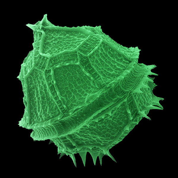 Subject: Pyrodinium spp. A Dinoflagelate responsible of Bioluminescence in Parguera Bay; Credit: Jose Almodovar, University of Puerto Rico Mayaguez Campus; Method/Instrument: JEOL 5410LV