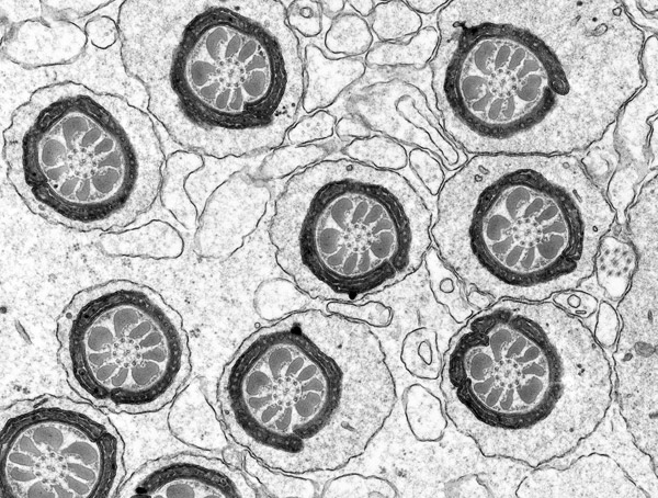 Subject: Cross-section through middle pieces of developing spermatids in seminiferous tubule epithelium (adult male rat).; Credit: Dr. Patrick C. Nahirney, University of Victoria; Instrument: JEM-1400 TEM