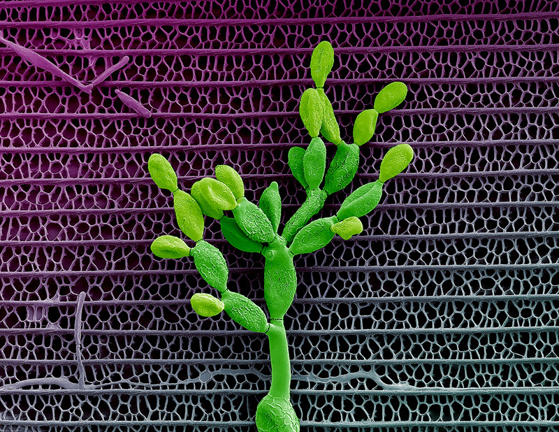 TITLE: Butterfly cactus; SUBJECT: Conidiophore and conidia of a fungus growing on a butterfly wing; CREDIT: Vijayasankar Raman, University of Mississippi; METHOD/INSTRUMENT: JEOL JSM-7200F