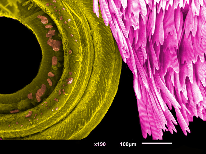 SUBJECT: A butterfly’s mouth is a long tube, through which it sucks the sweet nectar from flowers. When the butterfly does not want to eat, it rolls the tube up!; CREDIT: SAURABH PARMAR, Dr.K.C.Patel R & D Center, CHARUSAT; METHOD/INSTRUMENT: JEOL JSM 6010LA