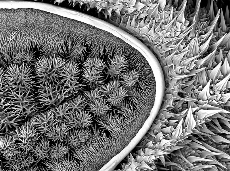 TITLE: Spiky Caterpillar; SUBJECT: Microstructure of a black and white spiky caterpillar; CREDIT: Sheri Neva, Eurofins - EAG Los Angeles; METHOD/INSTRUMENT: JEOL 6610LV SEM
