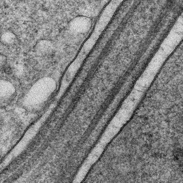 SUBJECT: Connecting cilium of a C57BL/6J mouse rod photoreceptor.; CREDIT: Stefanie Volland, UCLA; METHOD/INSTRUMENT: JEOL TEM (JEM1200-EX) - Transcardiac perfusion fixation with an aldehyde mix; post-fixation with tannic acid and uranyl acetate. Araldite ultrathin sections for TEM imaged at 80kv.