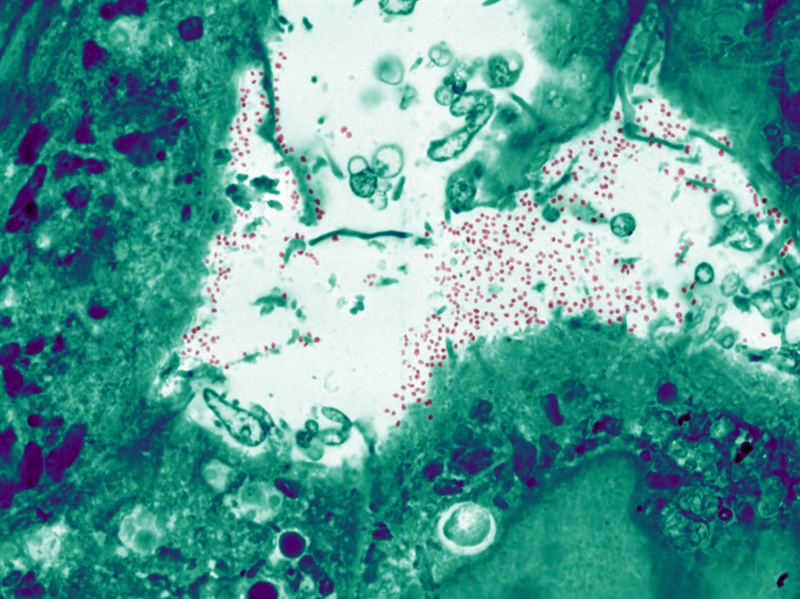 SUBJECT: Covid19 infected cells; CREDIT: Jonathan Franks, Center for Biologic Imaging; METHOD/INSTRUMENT: JEOL JSM-6335F SEM