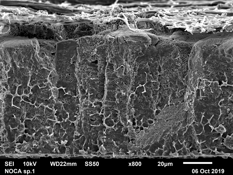 SUBJECT: JSM 6610LV at high vacuum mode with an accelerating beam voltage of 10 kV and emission current 10 µA; CREDIT: Poongodi Geetha-Loganathan, Ph.D., SUNY Oswego; METHOD/INSTRUMENT: JEOL JSM 6610LV SEM