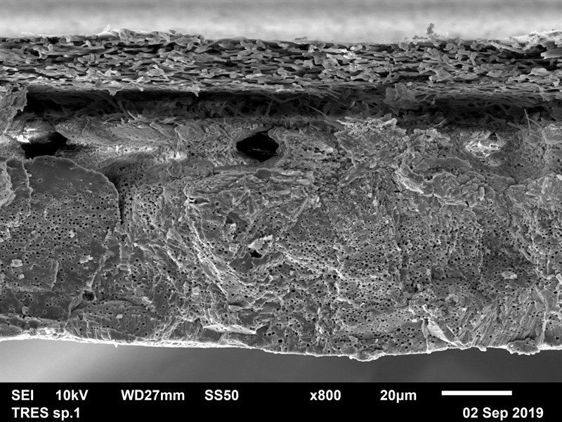 SUBJECT: JSM 6610LV at high vacuum mode with an accelerating beam voltage of 10 kV and emission current 10 µA; CREDIT: Poongodi Geetha-Loganathan, Ph.D., SUNY Oswego; METHOD/INSTRUMENT: JEOL JSM 6610LV SEM