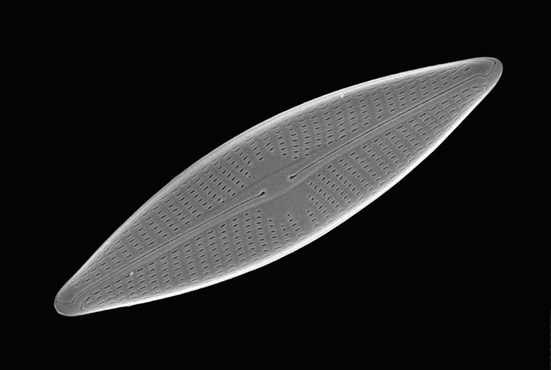 SUBJECT: Diatom; CREDIT: Jonathan Franks, Center for Biologic Imaging; METHOD/INSTRUMENT: JEOL JSM-6335F SEM