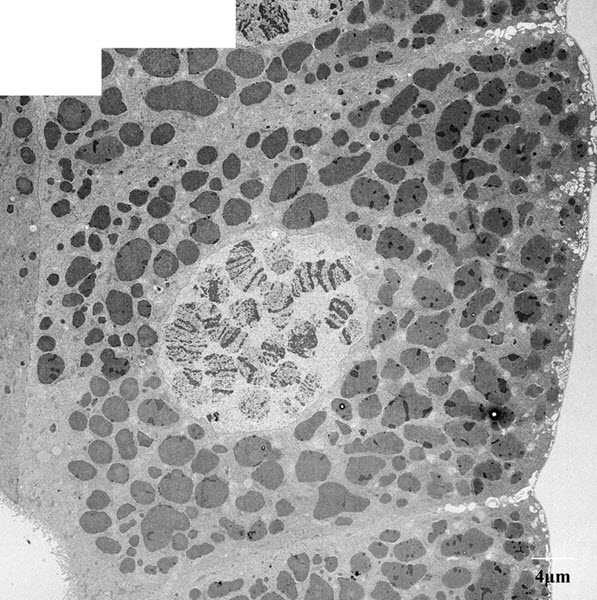SUBJECT: Montage method for imaging Drosophila thrid instar salivary gland. Highlights the polytene chromosomes and secretive vesicles in these cells; CREDIT: Zhongyuan Zuo, Baylor College of Medicine; METHOD/INSTRUMENT: JEOL JEM-1010