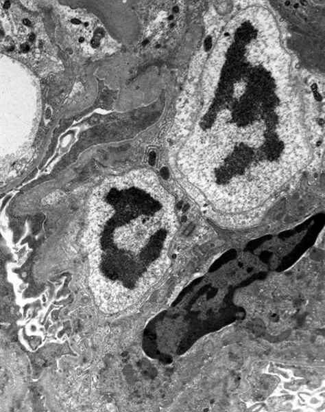 SUBJECT: Human Kidney Glomerulus; CREDIT: Janet Schwarz, The University of Vermont Microscopy Imaging Center; METHOD/INSTRUMENT: JEM-1400 TEM