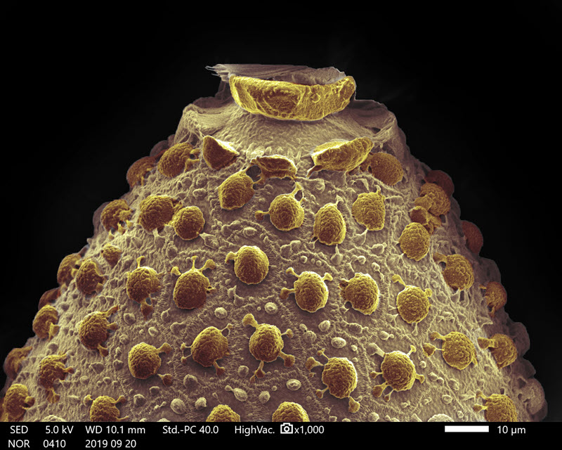 TITLE: Cheese volcano; SUBJECT: Egg surface of mosquito Aedes aegypti; CREDIT: Rachel Rachid, Jander Matos, and Diego Regalado, Center for Analysis of Biomedical Phenomena of the University of State of Amazonas - CMABio/UEA; METHOD/INSTRUMENT: JSM-IT500HR