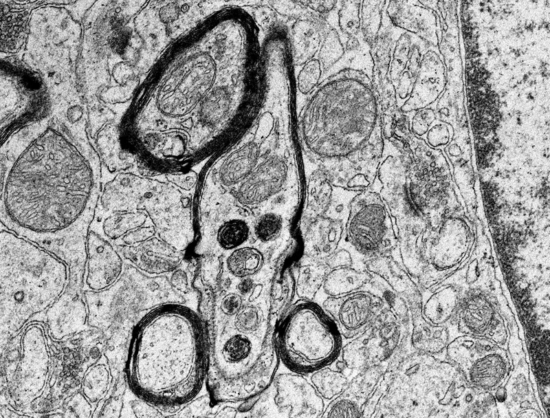 SUBJECT: micrograph of an Alzheimer's disease-related gene expressed in mouse hippocampus region; CREDIT: Zhongyuan Zuo, Baylor College of Medicine; METHOD/INSTRUMENT: JEOL 1010