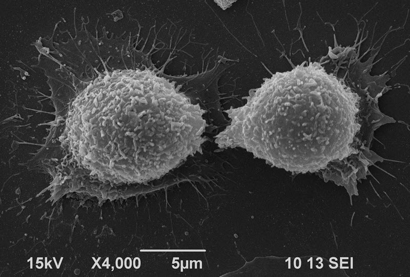 SUBJECT: B16F10 melanoma cells in the last step of mitosis; CREDIT: Maria de los Angeles Ramirez, CIC biomaGUNE, San Sebastian, España; METHOD/INSTRUMENT: SEM JEOL JSM-6490LV