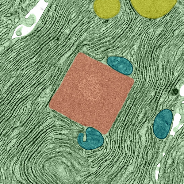 SUBJECT: Psuedocolored TEM image of mouse pancreatic acinar cell. (Red = Paracrystalline inclusion body; Yellow = secretory granules; Blue = mitochondria; Green = cytoplasm filled with rough endoplasmic reticulum.) ; CREDIT: Patrick Nahirney, University of Victoria; METHOD/INSTRUMENT: JEM 1400 Image captured at 25,000 times magnification with a Gatan Orius SC1000 camera
