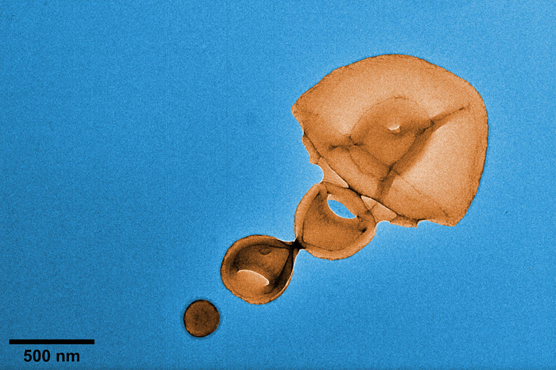 TITLE: Nano-Jellyfish; SUBJECT: Colorized TEM image of polymeric nano-jellyfish developed via aqueous polymerization-induced self-assembly (PISA); CREDIT: Spyridon Varlas, University College London; METHOD/INSTRUMENT: JEOL JEM-2100 TEM