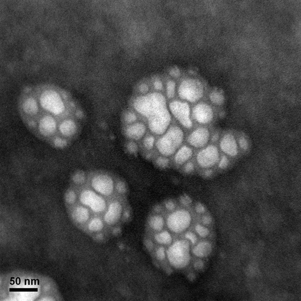 SUBJECT: Lipid-based nanoparticle ; CREDIT: CHUAN-EN LU, Department of Science in Biochemical Science and Technology, National Taiwan University