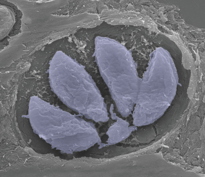 SUBJECT: Tachyzoites of Toxoplasma gondii replicating in a vacuole inside the host cell; CREDIT: Leandro Lemgruber, University of Glasgow; METHOD/INSTRUMENT: JEOL IT-100
