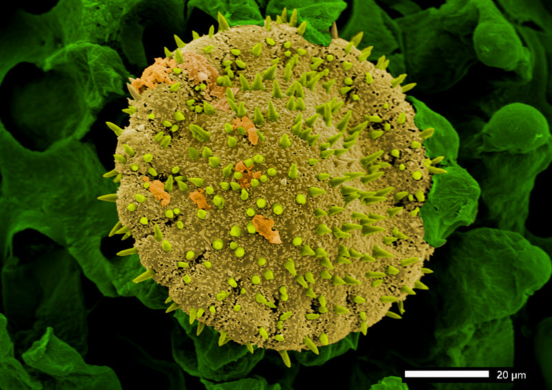 SUBJECT: Pollen of Richardia scabra L. (Ribiaceae); CREDIT: Fabio Dossi, ITP; METHOD/INSTRUMENT: JSM-IT200LA