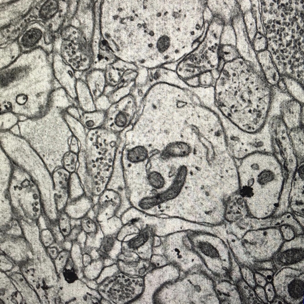 TITLE: Smirking cell; SUBJECT: A face found in a dendrite within the amygdala of a monkey brain. The facial features are composed of mitochondria, elsewhere, synaptic vesicles can be seen in this brain tissue which is densely packed with axons and dendrites; CREDIT: Jess Holz; METHOD/INSTRUMENT: JEOL 100-CX TEM