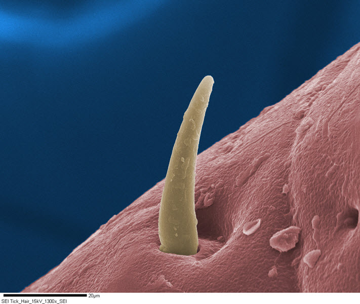 SUBJECT: Seta (bristle/hair) of a tick found in Michigan's Upper Peninsula; CREDIT: Jeffrey Brookins, Michigan Technological University; METHOD/INSTRUMENT: JEOL JSM-6400 @ 15kV, coated, 1300x, WD 39mm. Post-processed to add color to the micrograph.