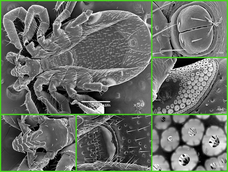 SUBJECT: Tick nymph (Arachnidae) in old SEM with W filament; CREDIT: Janez Zavašnik, Jožef Stefan Institute; METHOD/INSTRUMENT: JSM-5800