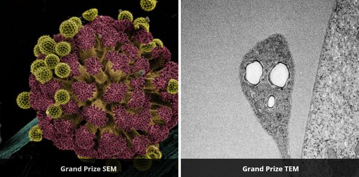 Scanning Electron Microscope Sem
