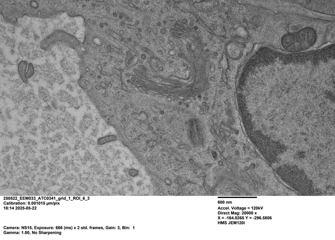Albert’s cryopreserved brain endothelial cell, imaged with the JEM-120i