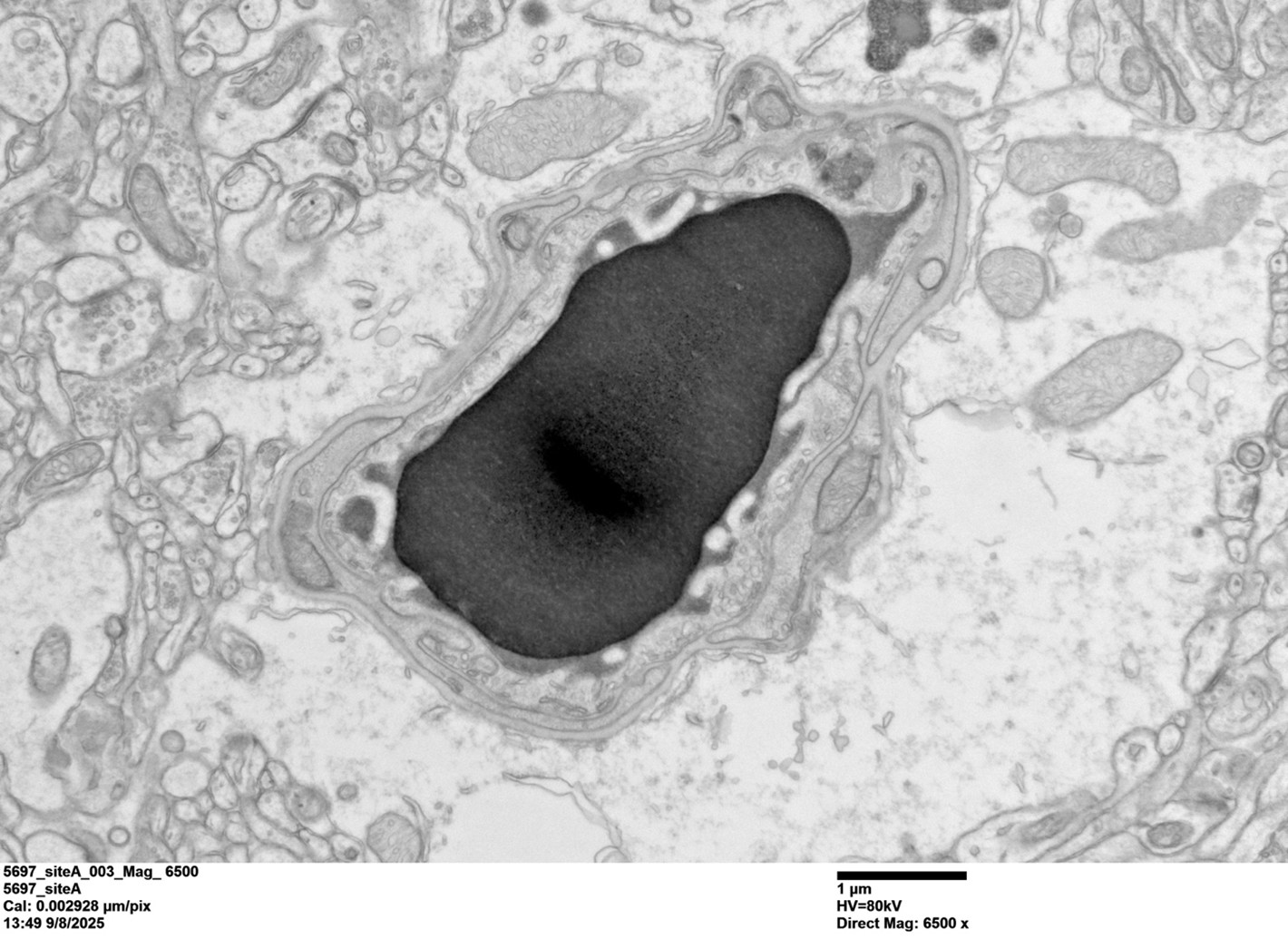 Lucy’s TEM Image of a Cortical Capillary from a WT mouse brain, imaged with the JEM-120i