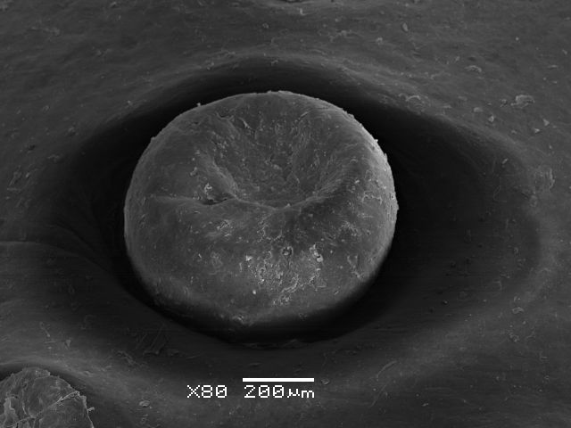 Gustative fungiform papillae of fallow deer (Dama dama) tongue.