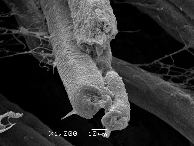 Fibers of retractor bulbi muscle of the eye of southern Minke whale (Balaenoptera bonaerensis).