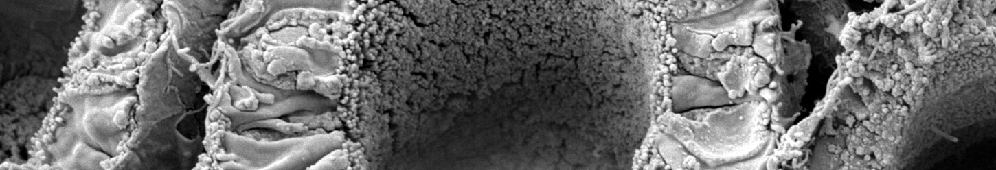 Scanning Electron Microscope Sem