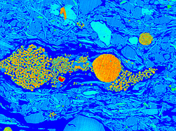 Image Alt Text