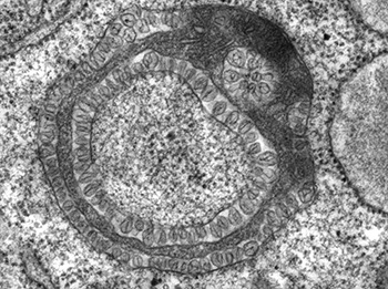 Image Alt Text