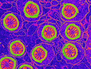 Image Alt Text