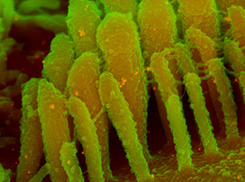 Image Alt Text
