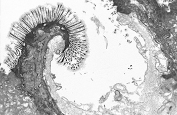 Image Alt Text